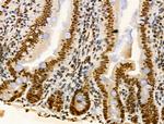 PIASy Antibody in Immunohistochemistry (Paraffin) (IHC (P))