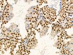 PIASy Antibody in Immunohistochemistry (Paraffin) (IHC (P))