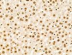 PIASy Antibody in Immunohistochemistry (Paraffin) (IHC (P))