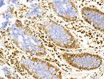 PIASy Antibody in Immunohistochemistry (Paraffin) (IHC (P))