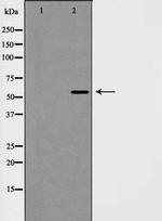 PIASy Antibody in Western Blot (WB)