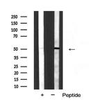 Cytokeratin 15 Antibody in Western Blot (WB)