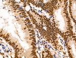 Ku70/Ku80 Antibody in Immunohistochemistry (Paraffin) (IHC (P))