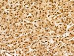 Ku70/Ku80 Antibody in Immunohistochemistry (Paraffin) (IHC (P))