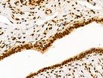 Ku70/Ku80 Antibody in Immunohistochemistry (Paraffin) (IHC (P))