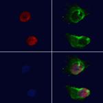 Ku70/Ku80 Antibody in Immunocytochemistry (ICC/IF)