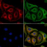 HSL Antibody in Immunocytochemistry (ICC/IF)