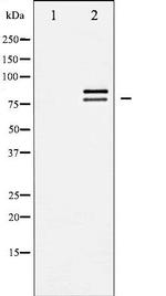 HSL Antibody in Western Blot (WB)