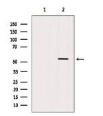 CaMKII alpha/beta/delta Antibody in Western Blot (WB)