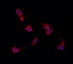 EPS8L3 Antibody in Immunocytochemistry (ICC/IF)