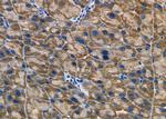 EPS8L3 Antibody in Immunohistochemistry (Paraffin) (IHC (P))