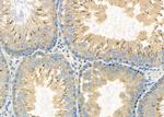 EPS8L3 Antibody in Immunohistochemistry (Paraffin) (IHC (P))