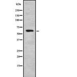 HABP2 Antibody in Western Blot (WB)