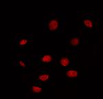 DUSP4 Antibody in Immunocytochemistry (ICC/IF)