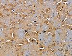 RAB3IP Antibody in Immunohistochemistry (Paraffin) (IHC (P))