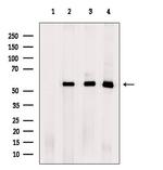 RAB3IP Antibody in Western Blot (WB)