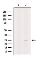 MAGEH1 Antibody in Western Blot (WB)