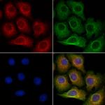 FDCSP Antibody in Immunocytochemistry (ICC/IF)