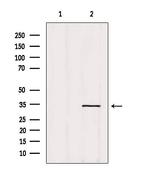 OR14A16 Antibody in Western Blot (WB)