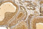 SHARPIN Antibody in Immunohistochemistry (Paraffin) (IHC (P))