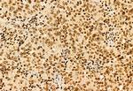 SHARPIN Antibody in Immunohistochemistry (Paraffin) (IHC (P))