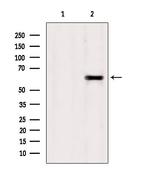 TCTN1 Antibody in Western Blot (WB)