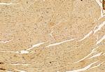 RAB27B Antibody in Immunohistochemistry (Paraffin) (IHC (P))