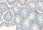 RAB27B Antibody in Immunohistochemistry (Paraffin) (IHC (P))