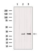 RAB27B Antibody in Western Blot (WB)