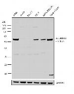 ALDH1A1 Antibody in Western Blot (WB)