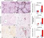 Myeloperoxidase Antibody in Immunohistochemistry (IHC)