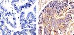 beta Tubulin Antibody in Immunohistochemistry (Paraffin) (IHC (P))