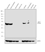 GLT-1 Antibody in Western Blot (WB)