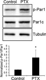 Phospho-MARK1/MARK2/MARK3 (Thr215, Thr208, Thr234) Antibody in Western Blot (WB)