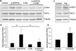 Phospho-MARK1/MARK2/MARK3 (Thr215, Thr208, Thr234) Antibody in Western Blot (WB)