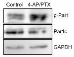 Phospho-MARK1/MARK2/MARK3 (Thr215, Thr208, Thr234) Antibody in Western Blot (WB)