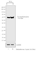 Tyrosine Hydroxylase Antibody in Western Blot (WB)