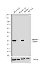 DARPP-32 Antibody