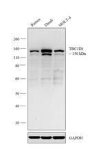 TBC1D1 Antibody in Western Blot (WB)