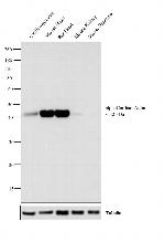 alpha-Cardiac Actin Antibody in Western Blot (WB)