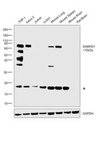 SAMHD1 Antibody in Western Blot (WB)