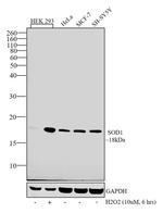 SOD1 Antibody in Western Blot (WB)