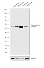 NUMB Antibody in Western Blot (WB)