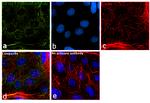 IGF2BP1 Antibody in Immunocytochemistry (ICC/IF)