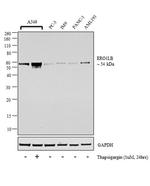ERO1LB Antibody in Western Blot (WB)