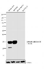 Carbonic Anhydrase III Antibody in Western Blot (WB)