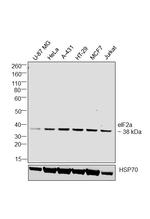 EIF2S1 Antibody in Western Blot (WB)