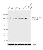 Blooms Syndrome Antibody in Western Blot (WB)