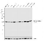 Carbonic Anhydrase II Antibody in Western Blot (WB)