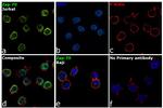 Zap-70 Antibody in Immunocytochemistry (ICC/IF)